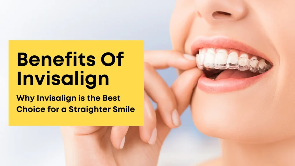 Benefits Of Invisalign